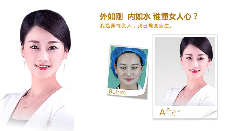 丹东V脸、线雕隆鼻